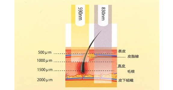 医療用新世代LEDヒーライトⅡとは？