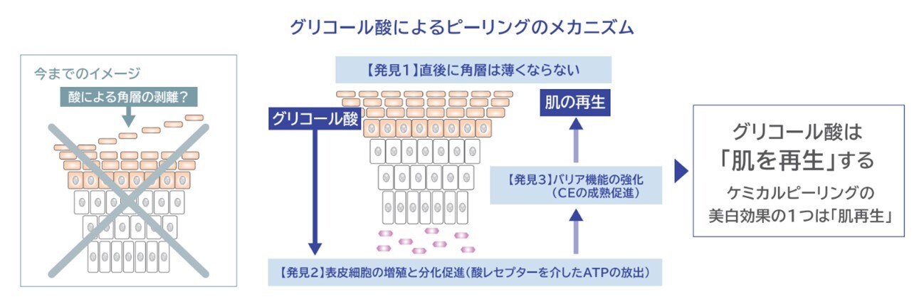 ニキビ